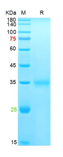 Recombinant SARS-Cov-2 Spike RBD protein (K417T, E484K, N501Y), His (HEK293)