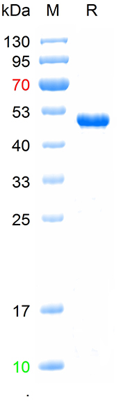 Recombinant SARS-Cov-2 (Omicron, B.1.1.529) N protein (P13L, E31del, R32del, S33del, R203K, G204R), N-His