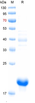 Recombinant human AMH protein, C-His (重组蛋白) | Bioss