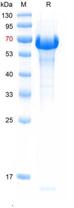 重组鸡新城疫血凝素蛋白