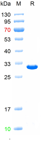 Recombinant human Complement C3d fragment protein, C-His (重组蛋白) | Bioss