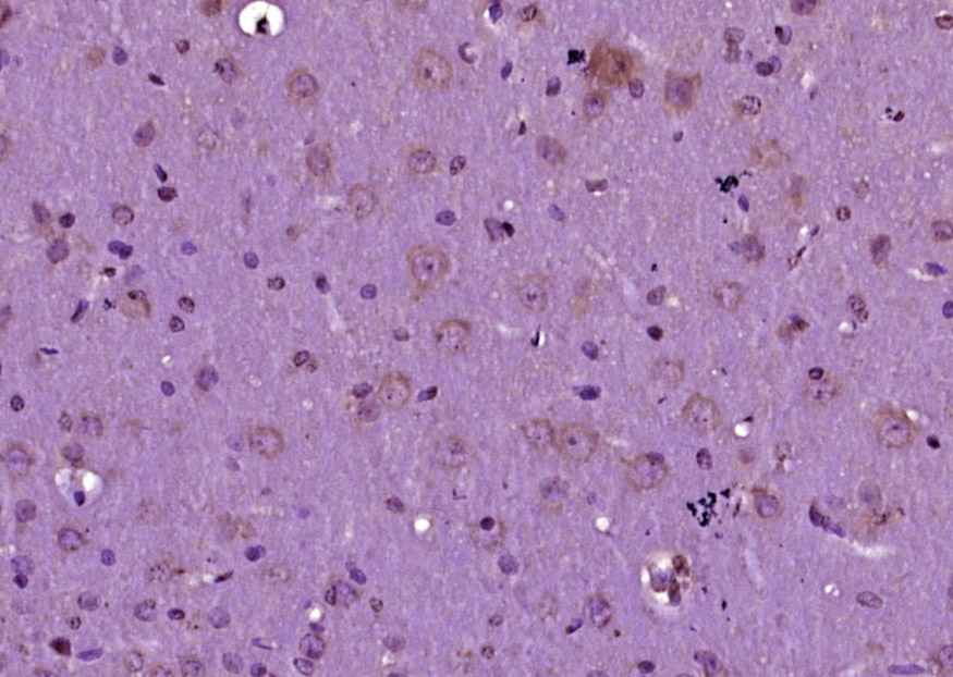 SMAD家族9抗体-bs-4253R