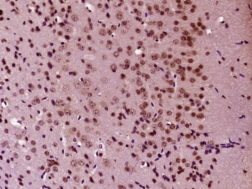 转录因子E2F8抗体-bs-4265R