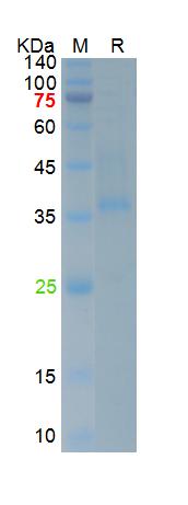 Recombinant SARS-Cov-2 Spike RBD protein (L452R,E484Q), His (HEK293)
