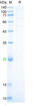 Recombinant SARS-Cov-2 Spike S1 protein (E484Q, L452R, D614G, P681R), His (HEK293)
