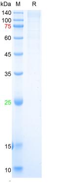 Recombinant SARS-Cov-2 Spike S1 protein (D80A, D215G, del241/243, K417N, E484K, N501Y, D614G), His (HEK293)