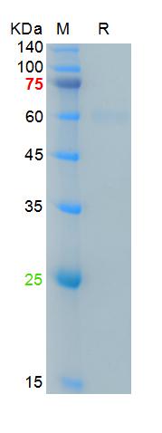 Recombinant SARS-Cov-2 Spike RBD protein, mFc (HEK293)