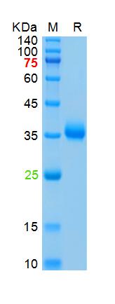 Recombinant SARS-Cov-2 Spike RBD protein, His (HEK293)