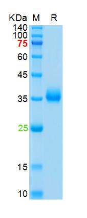 Recombinant SARS-Cov-2 Spike RBD protein (L452R,T478K), His (HEK293)