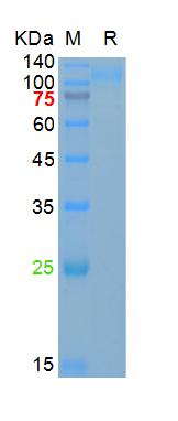 Recombinant SARS-Cov-2 Spike S1 protein (T19R, G142D, del157/158, L452R, T478K, D614G, P681R), His (HEK293)