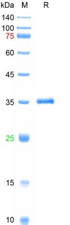 Recombinant SARS-Cov-2 Spike RBD protein (K417N, L452R,T478K), His (HEK293)
