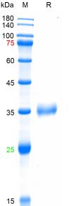 Recombinant SARS-Cov-2 Spike RBD protein (K417N, L452R,T478K), His (HEK293)
