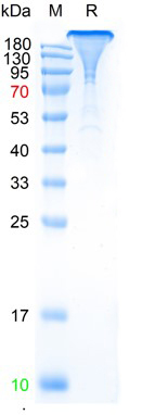 Recombinant SARS-Cov-2 Spike protein, Fc & Avi (HEK293)