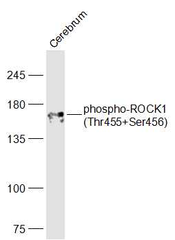 phospho-ROCK1 (Thr455+Ser456) Rabbit pAb (一抗) | Bioss