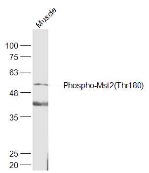 phospho-Mst2 (Thr180) Rabbit pAb (一抗) | Bioss