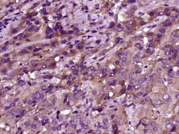 phospho-MST1 (Thr183) Rabbit pAb (一抗) - IHC-P,IHC-F,IF,Flow-Cyt | Bioss