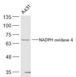 NADPH oxidase 4 Rabbit pAb (一抗) | Bioss