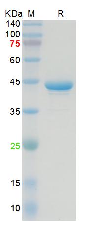 Recombinant SARS-Cov-1 N protein