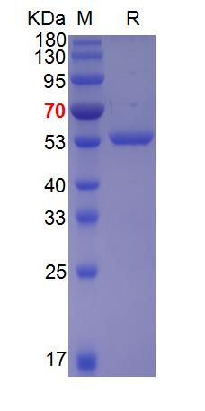 Recombinant EV71 polyprotein 3D protein, His (重组蛋白) | Bioss