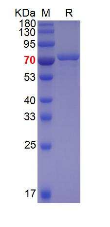 Recombinant EV71 polyprotein 3CD protein, His (重组蛋白) | Bioss