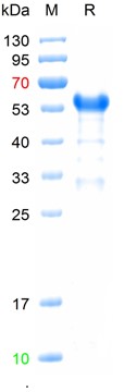 Recombinant HPV16 E7 protein, DsbC & His (重组蛋白) | Bioss