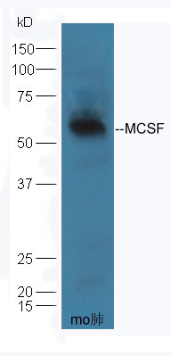 CSF1 Rabbit pAb (一抗) | Bioss