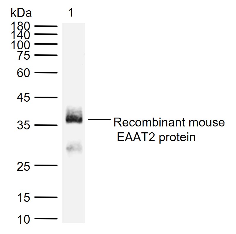 EAAT2 Rabbit pAb (一抗) - WB,IHC-P,IHC-F,IF | Bioss