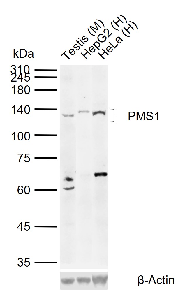 PMS1 Rabbit pAb (一抗) | Bioss