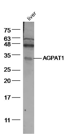 AGPAT1 Rabbit pAb (一抗) | Bioss