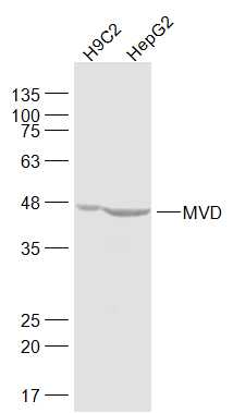 MVD Rabbit pAb (一抗) - WB,IHC-P,IHC-F,IF | Bioss