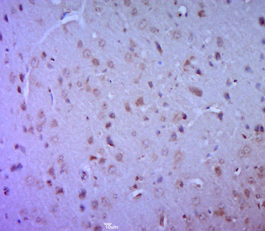 层粘连蛋白γ1抗体-bs-5122R