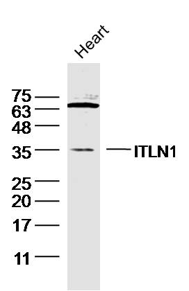 ITLN1 Rabbit pAb (一抗) | Bioss