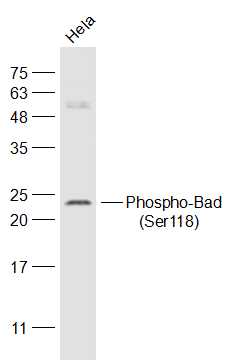 phospho-Bad (Ser118) Rabbit pAb (一抗) | Bioss