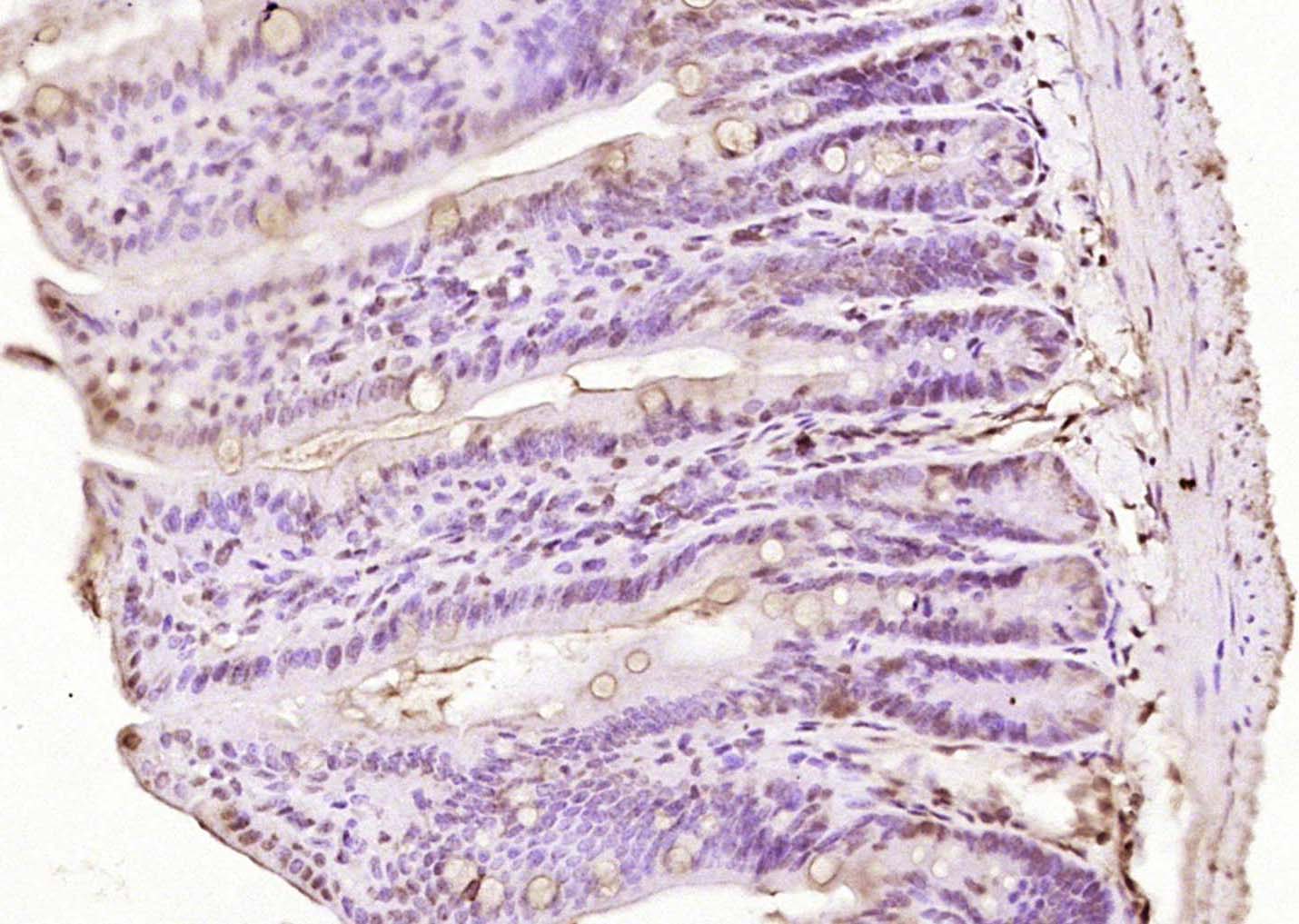 磷酸化组蛋白去乙酰化酶2抗体-bs-5389R
