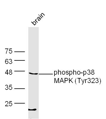 phospho-p38 MAPK (Tyr323) Rabbit pAb (一抗) - WB,IHC-P,IHC-F,IF | Bioss