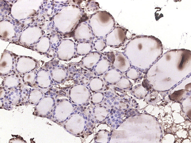 磷酸化p38MAPK抗体-bs-5477R