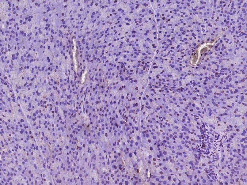 磷酸化p38MAPK抗体-bs-5477R