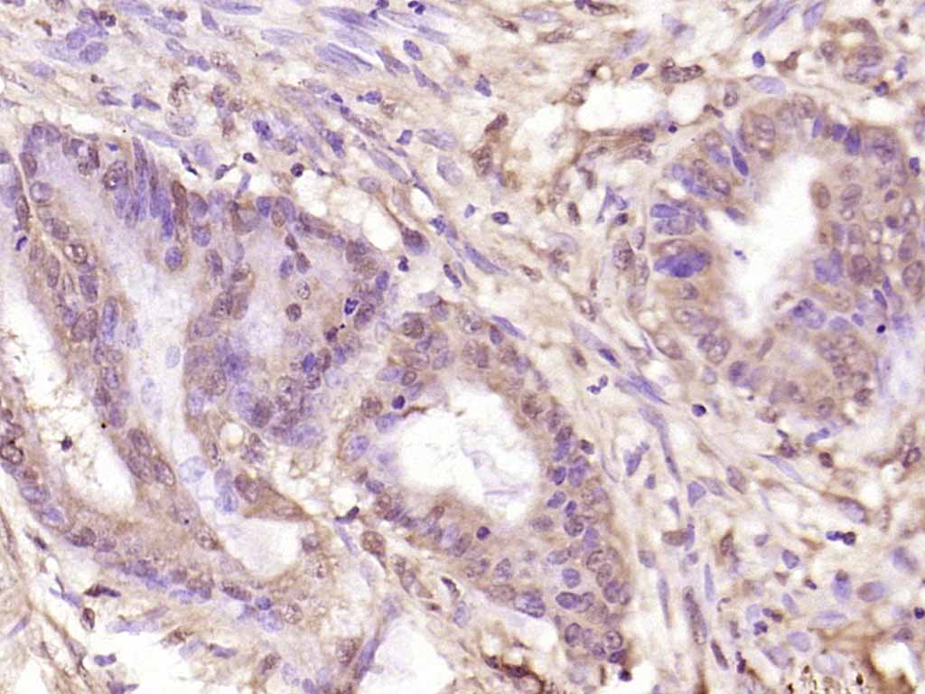 phospho-NFKB1 (Ser907) Rabbit pAb (一抗) | Bioss