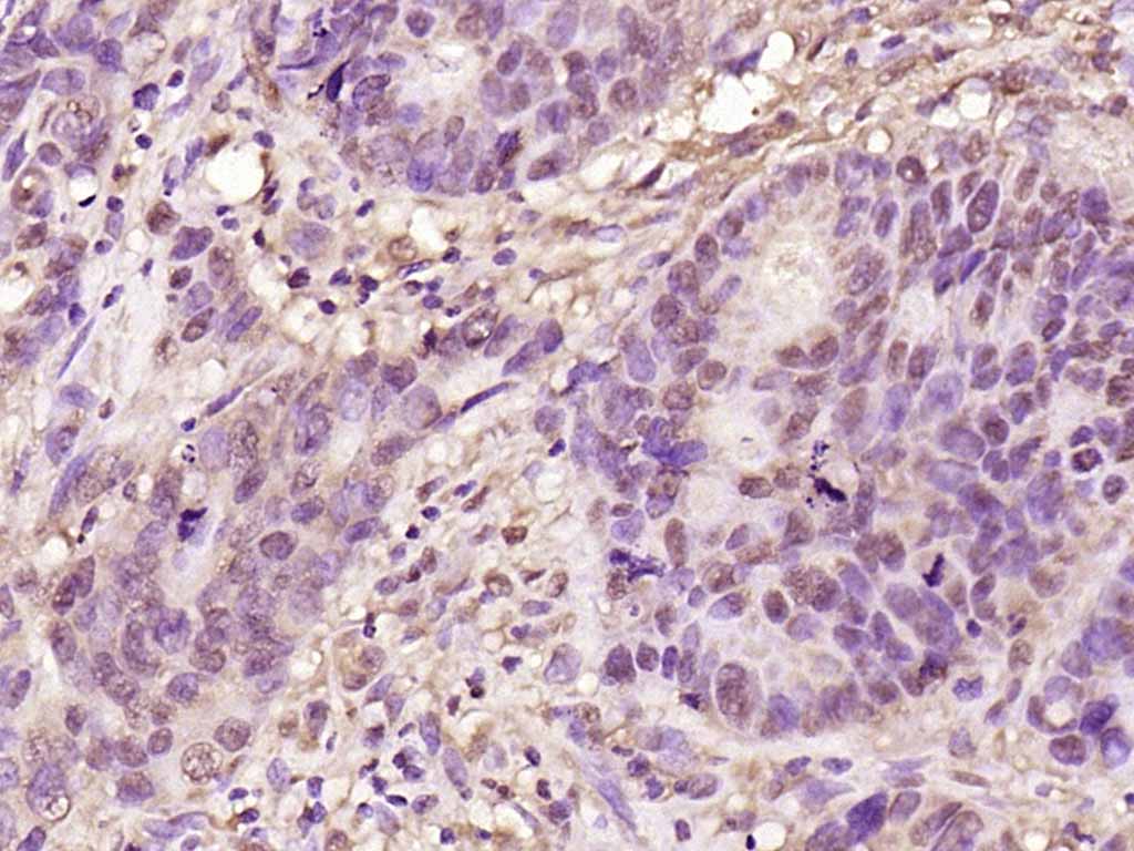 磷酸化细胞核因子p50/k基因结合核因子抗体-bs-5511R