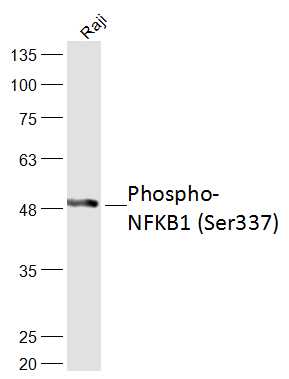 phospho-NFKB1 (Ser337) Rabbit pAb (一抗) | Bioss