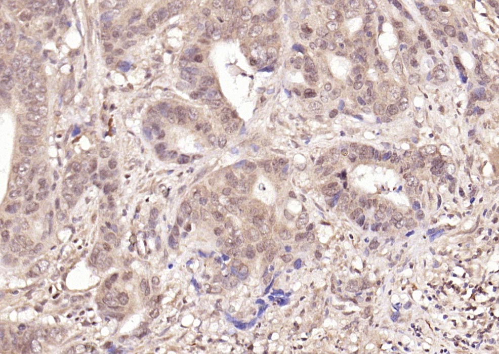 磷酸化细胞核因子p50/k基因结合核因子抗体-bs-5512R
