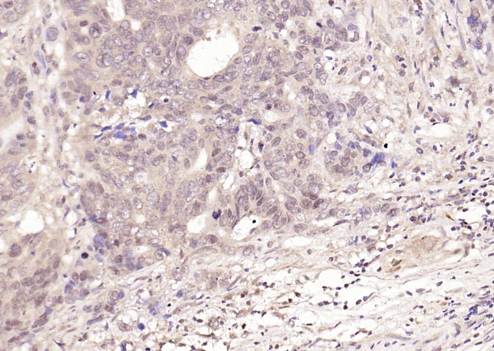 磷酸化细胞核因子p50/k基因结合核因子抗体-bs-5512R