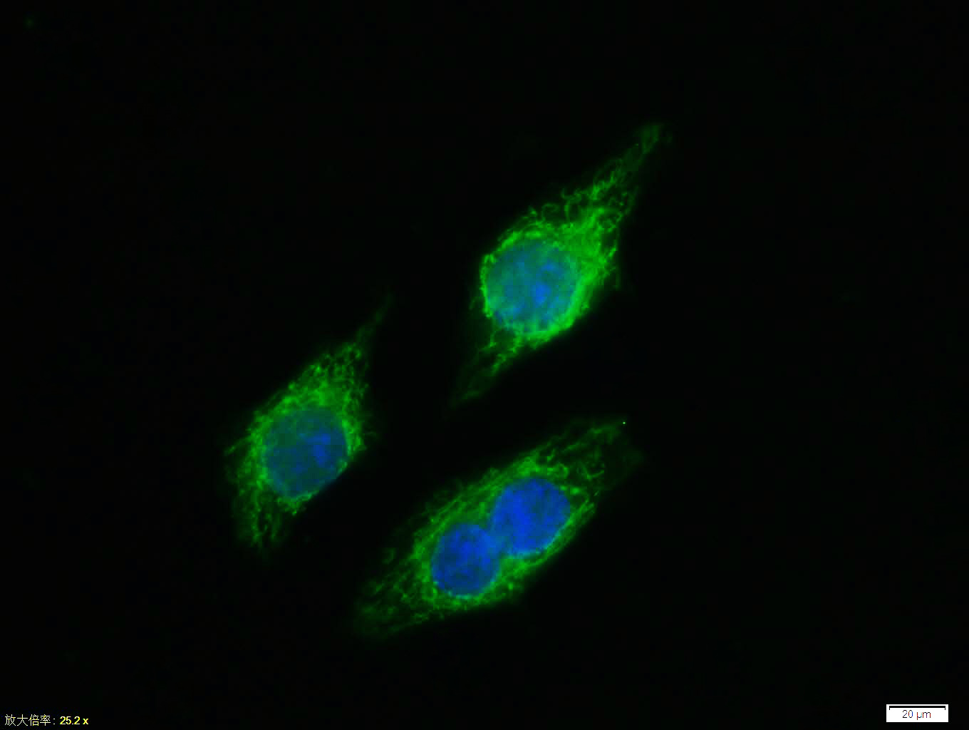 磷酸化细胞核因子抗体-bs-5661R