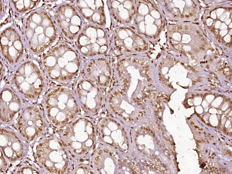 磷酸化细胞核因子抗体-bs-5662R