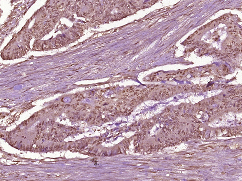 磷酸化细胞核因子抗体-bs-5662R