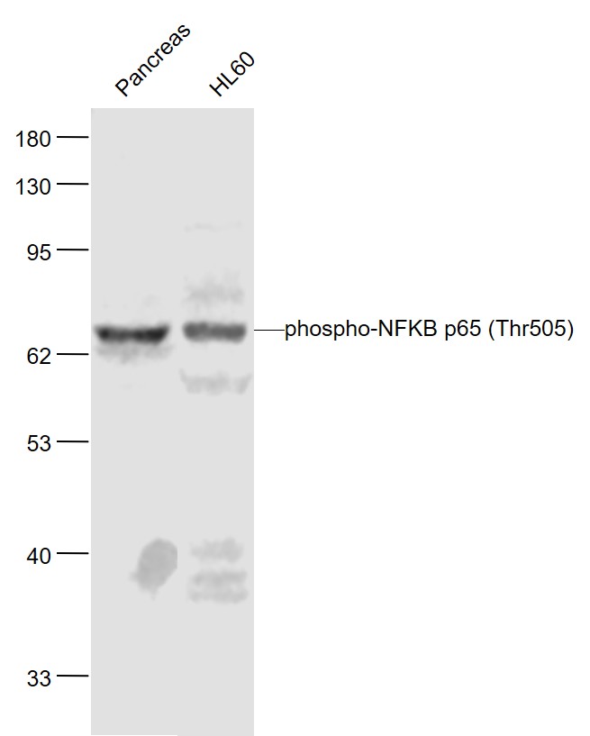 磷酸化细胞核因子抗体-bs-5663R