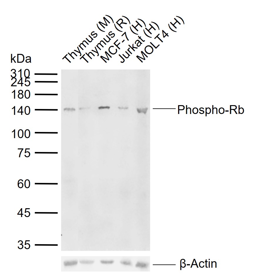 phospho-Rb (Ser795) Rabbit pAb (一抗) | Bioss