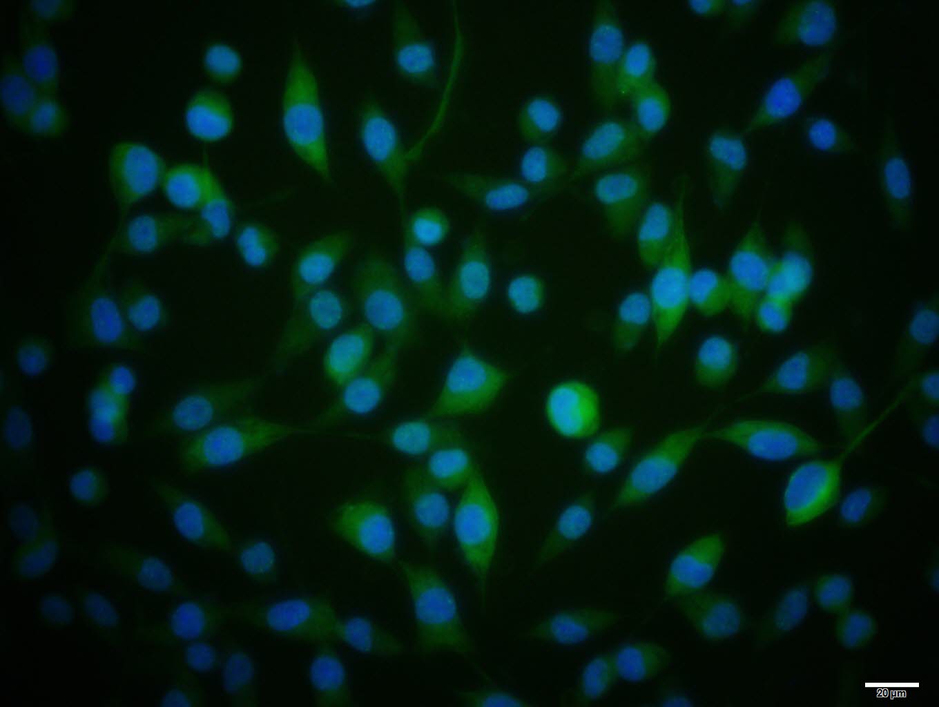 phospho-RAD51 (Thr309) Rabbit pAb (一抗) - ICC/IF | Bioss