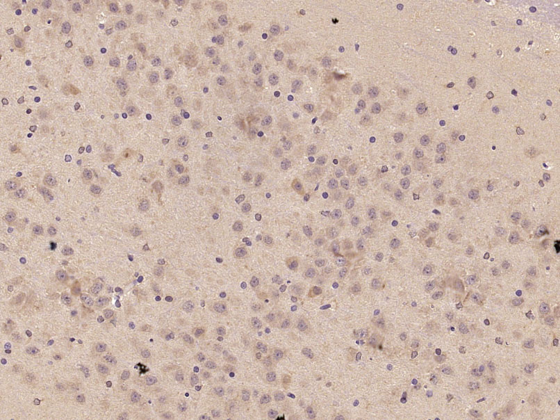 TNFAIP5 Rabbit pAb (一抗) - IHC-P,IHC-F,IF | Bioss