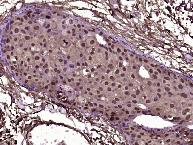 甲基化CpG结合蛋白抗体-bs-5915R